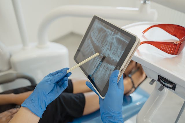 Retinuotas dantis: kodėl jis neišdygsta ir kaip vyksta jo šalinimas